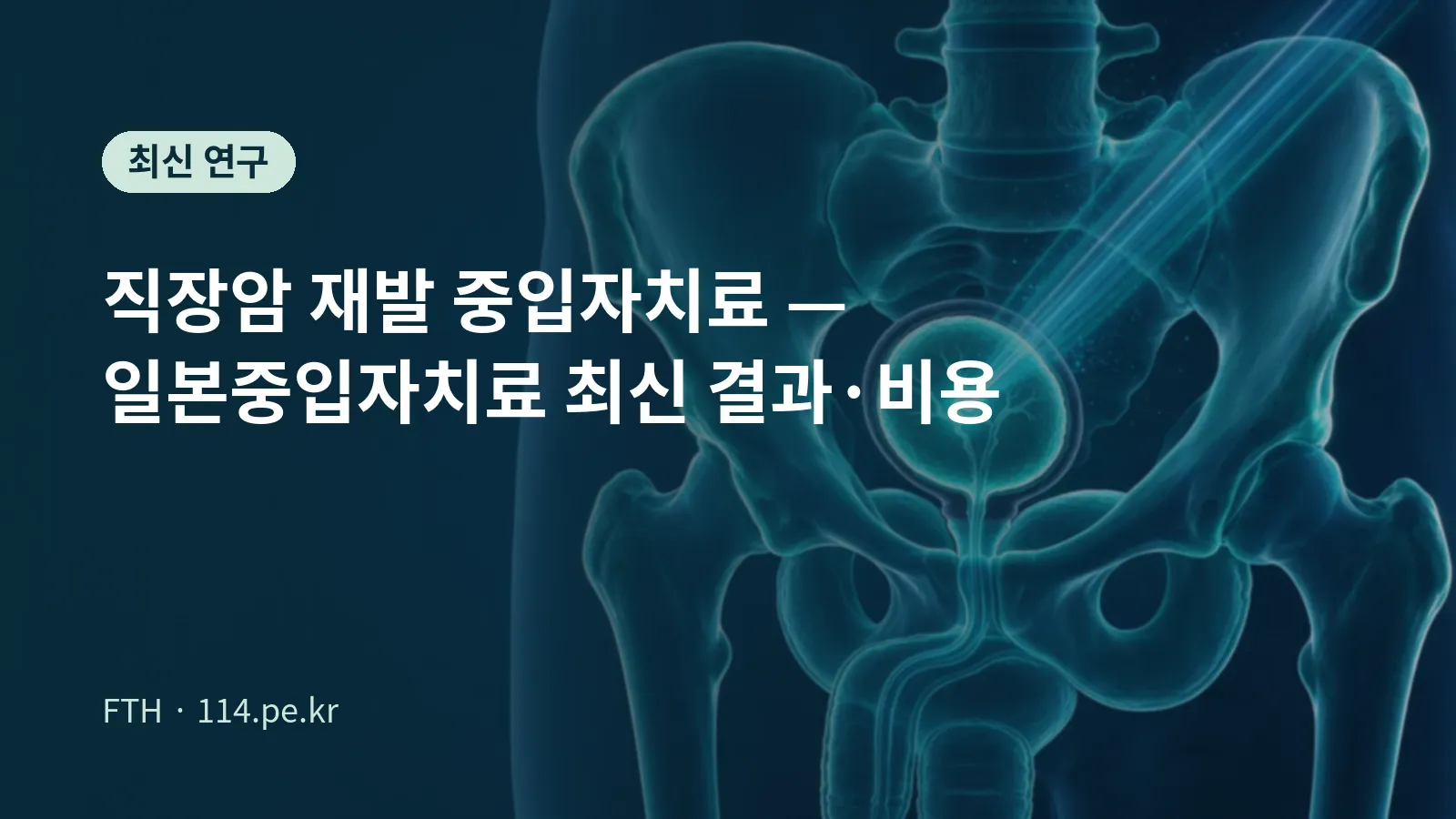 重离子束聚焦于盆腔内复发直肠癌的概念图